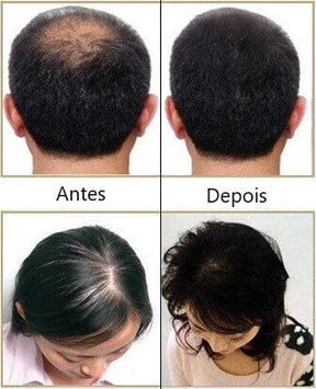 Escova a Laser – Terapia para Crescimento Capilar HairRise Saude & Beleza (Escova de cabelo 2) Dm Stores 